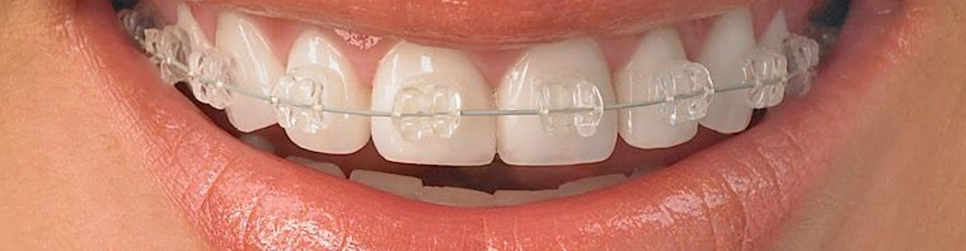 Dentista Vargas  : Para Que El Miedo Al Dentista No Sea Un Problema En Clínicas Clorofila.